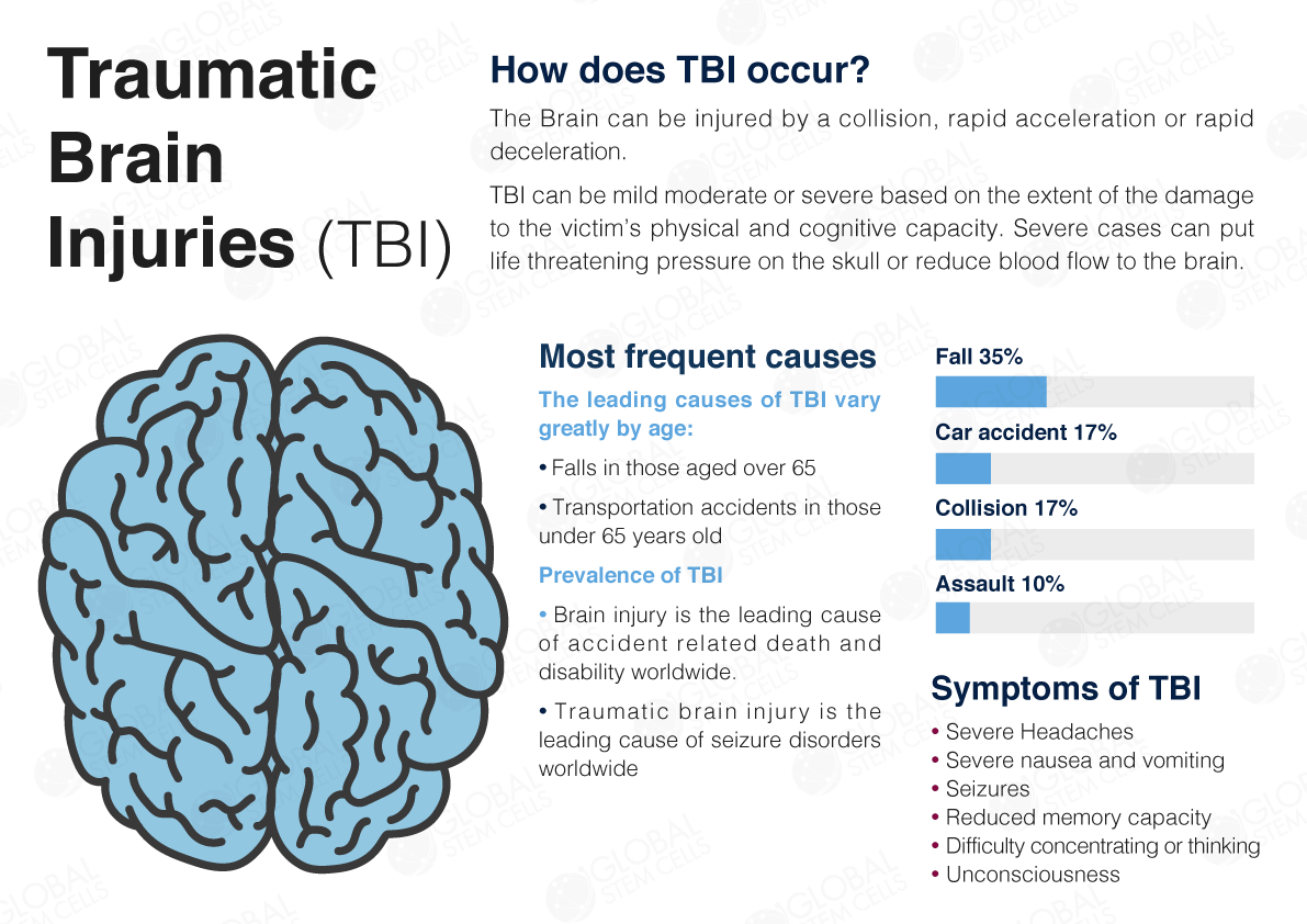 Traumatic Brain Injury Tbi Find The Best Stem Cell Treatment