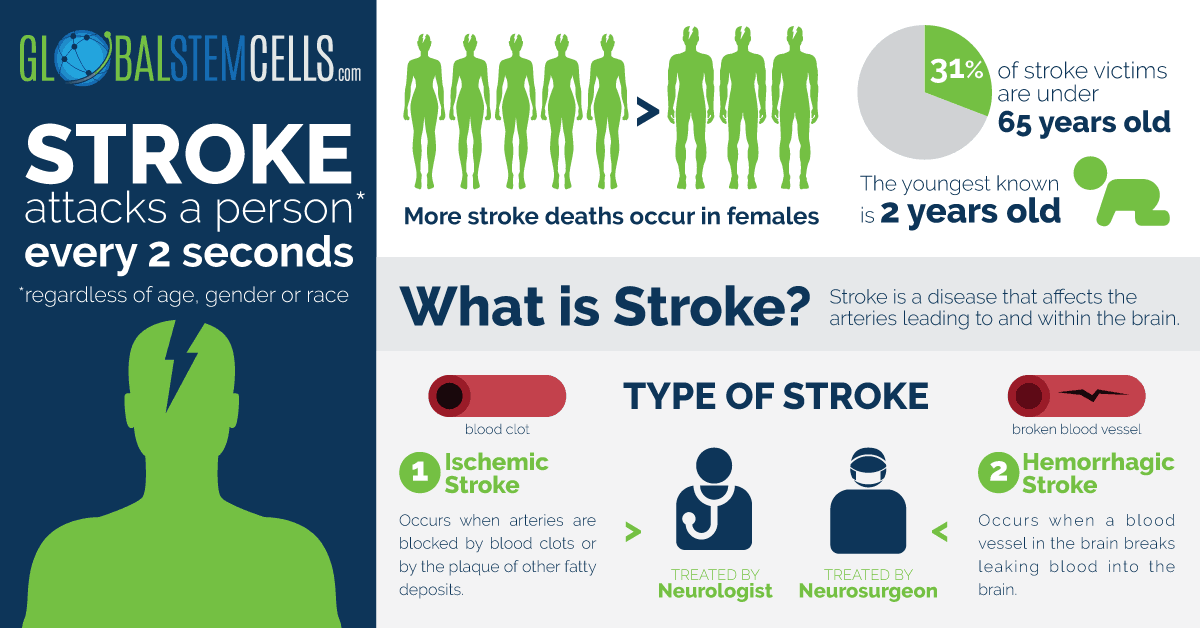 What Is A Stem Stroke