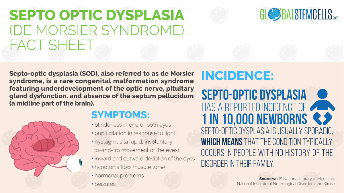 Septo Optic Dysplasia Fact Sheet | Global Stem Cells