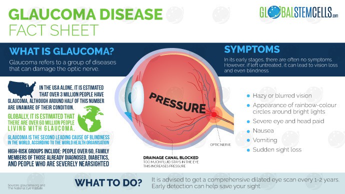 Glaucoma Infographic