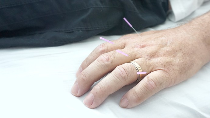 Acupuncture: How does it Work?