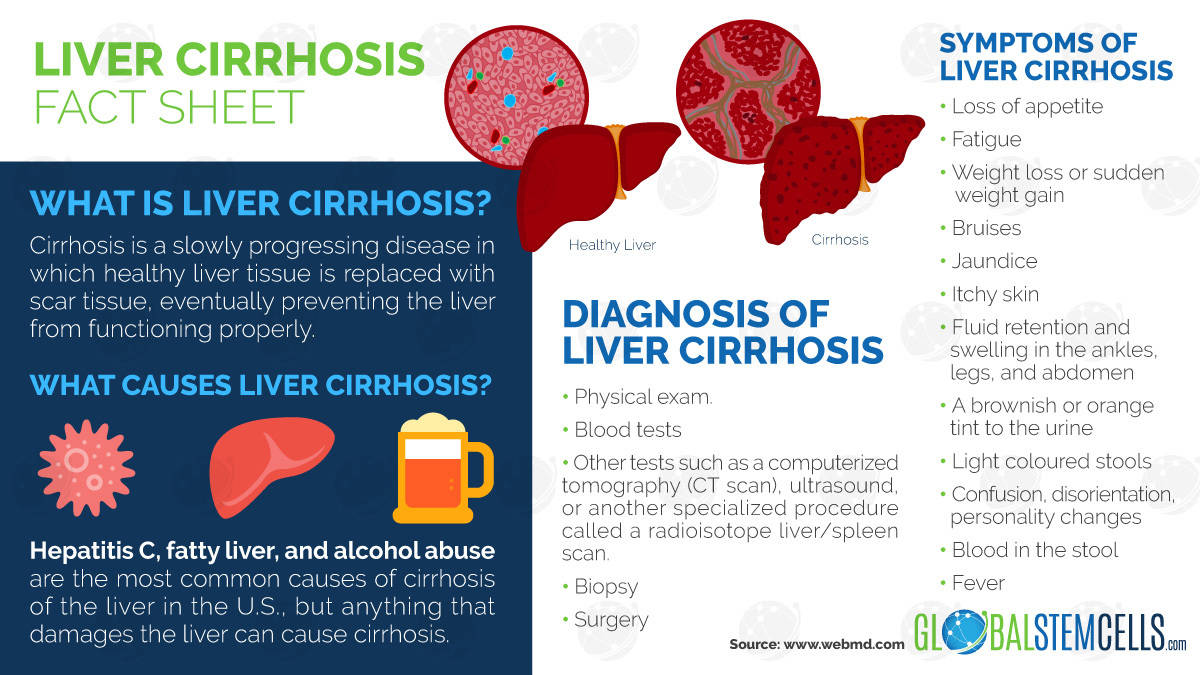 Liver Cirrhosis Infographic | Global Stem Cells