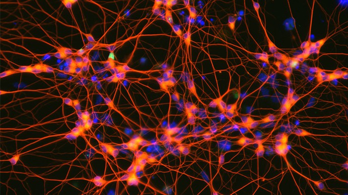 Stem Cells to Motor Neurons - A Scientific Discovery