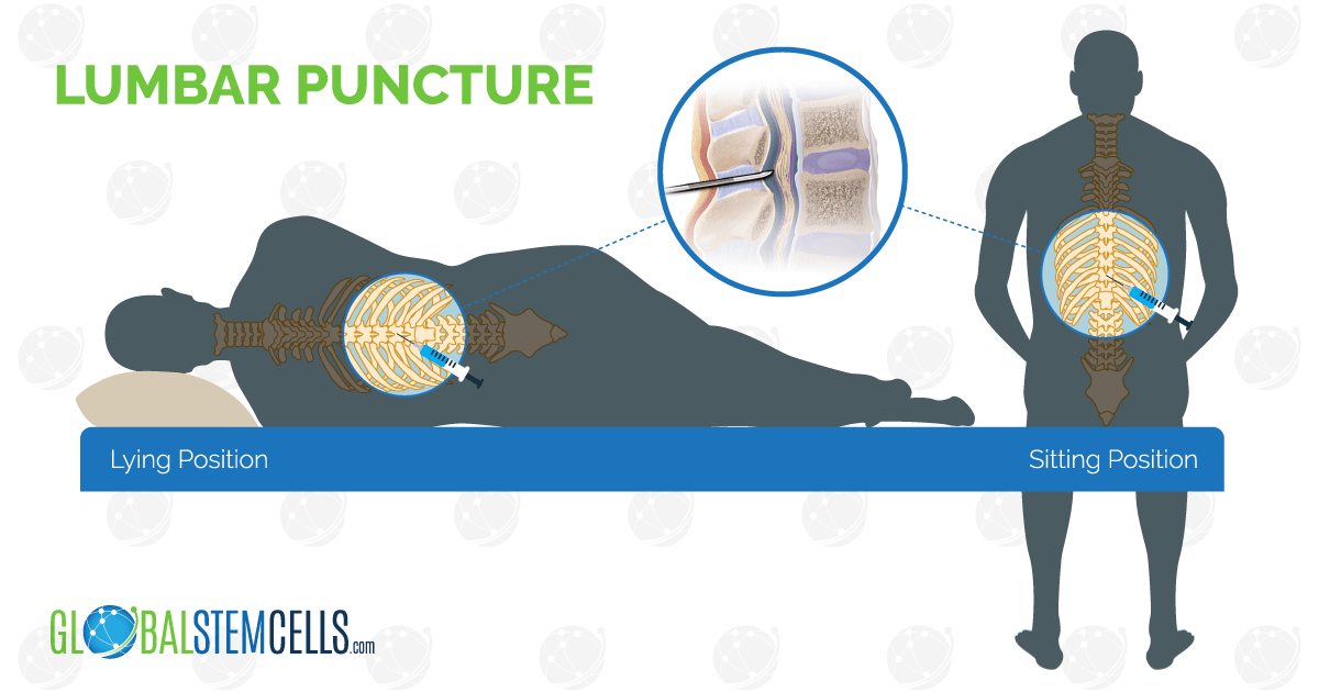 Lumbar Puncture Explained